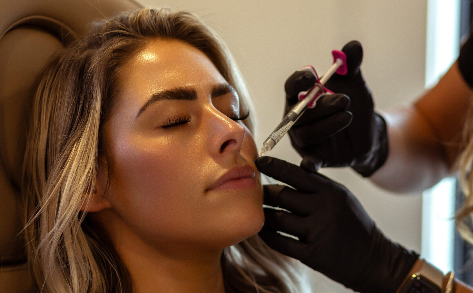 Dermal Fillers